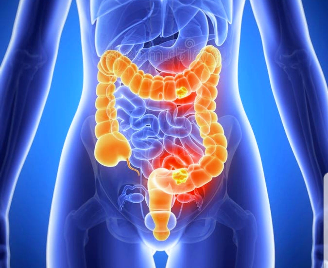 Colon Cleanser Tea Leave Her Wild Herbary